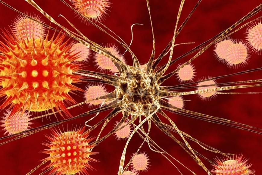 encefalite autoimmune